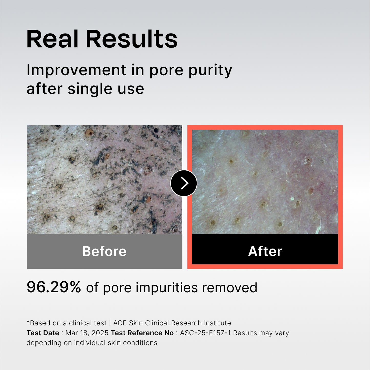 131 Pore Care BHA Cleanser