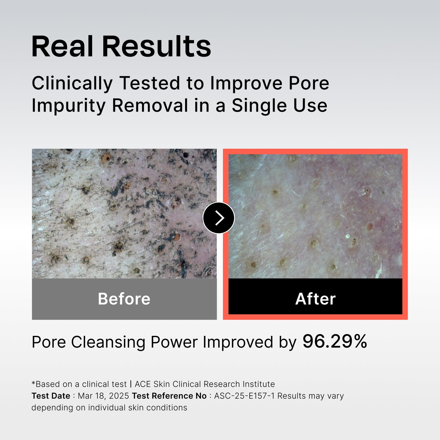 131 Pore Care BHA Cleanser | Celladix – Celladix US