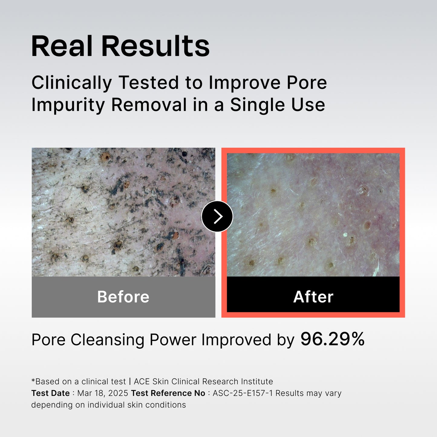 131 Pore Care BHA Cleanser