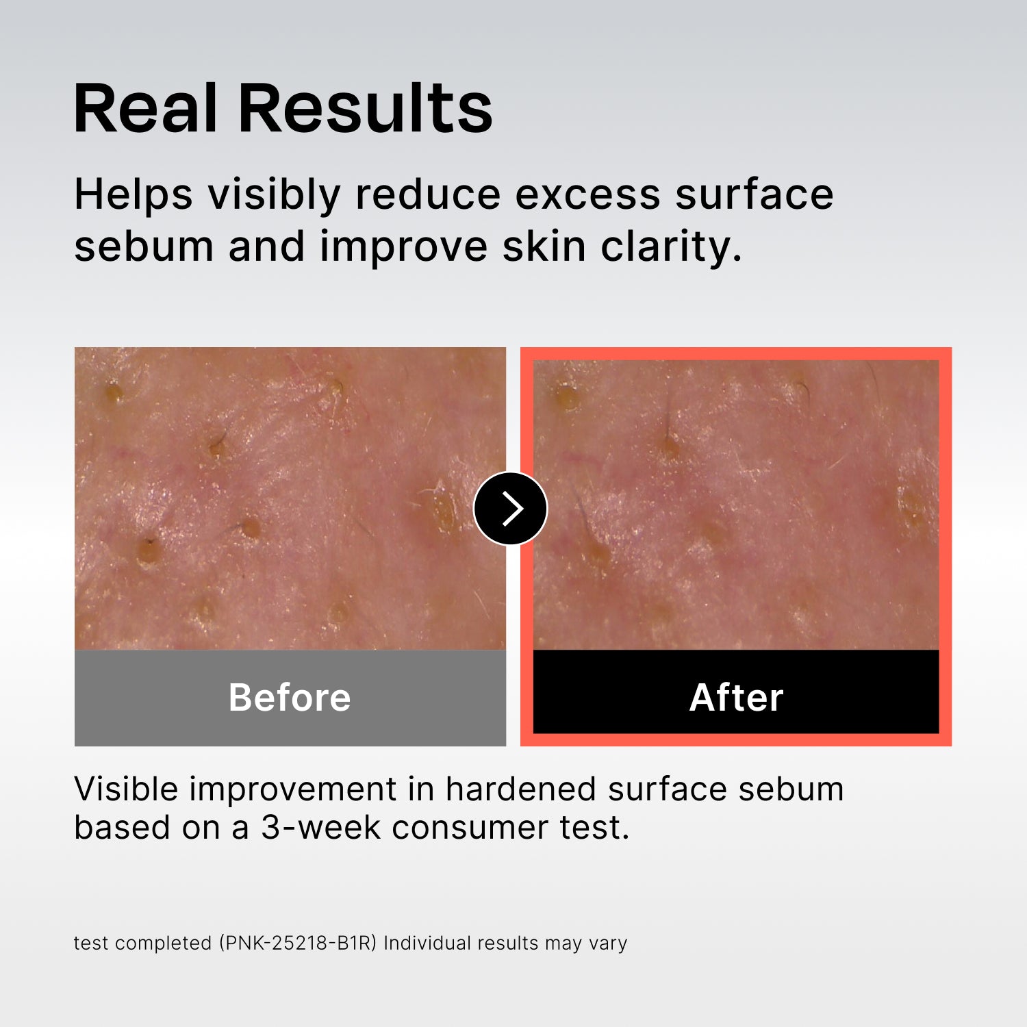 Sebum Rebalancing RX 131 Ampoule | Celladix – Celladix US