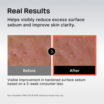 131 Pore Clearing Serum