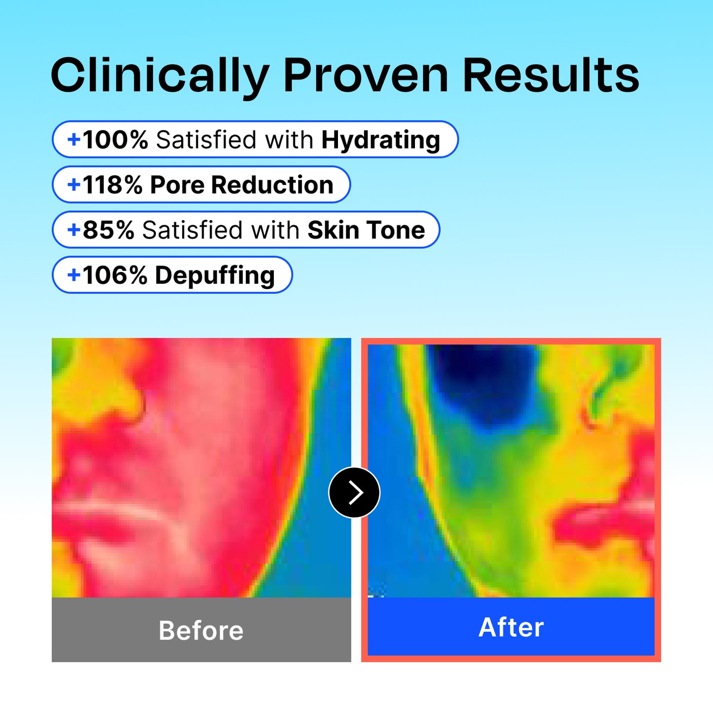 Hyaluronic Frozen Mask