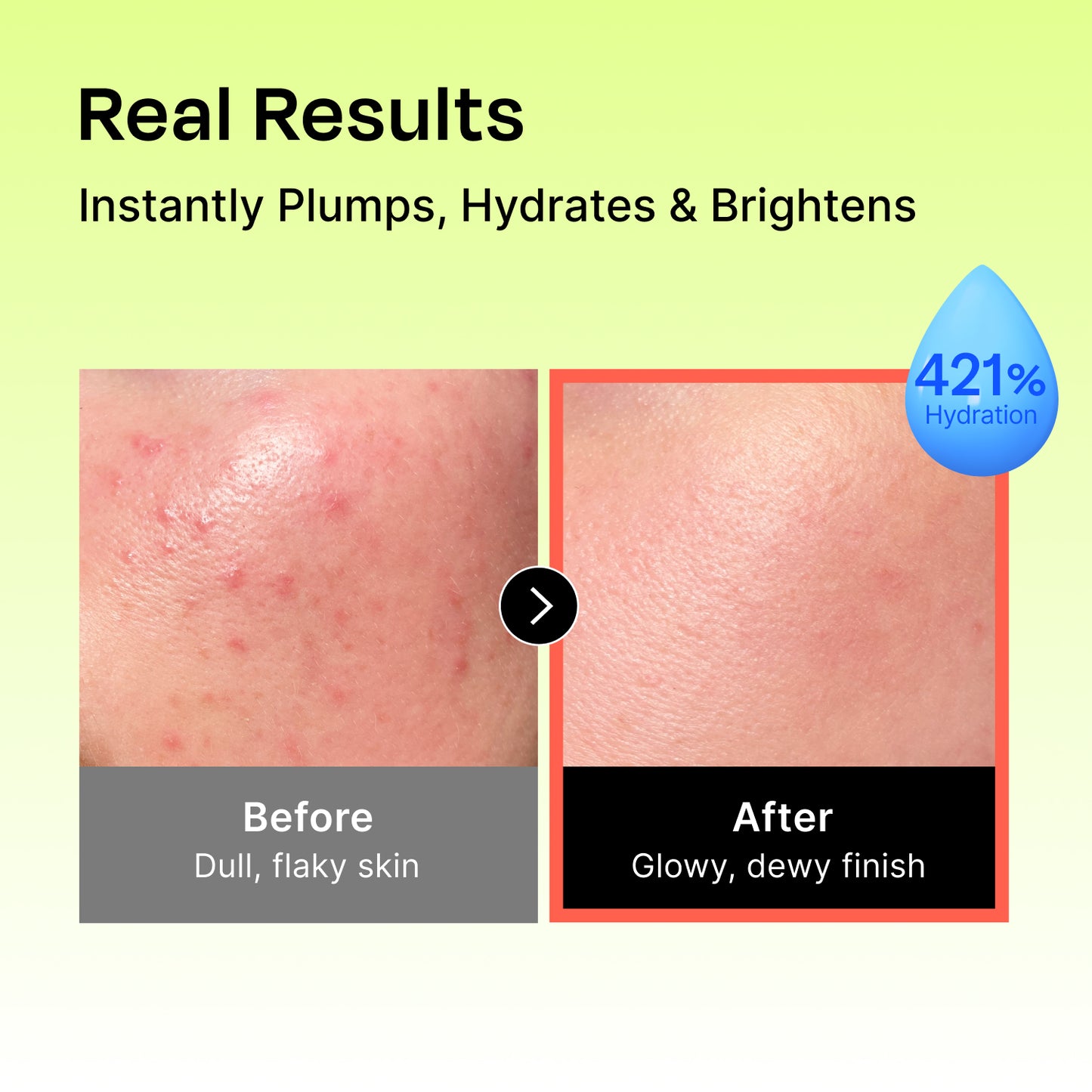 Hyaluronic Intense Cream