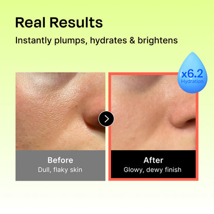 Hyaluronic Intense Serum