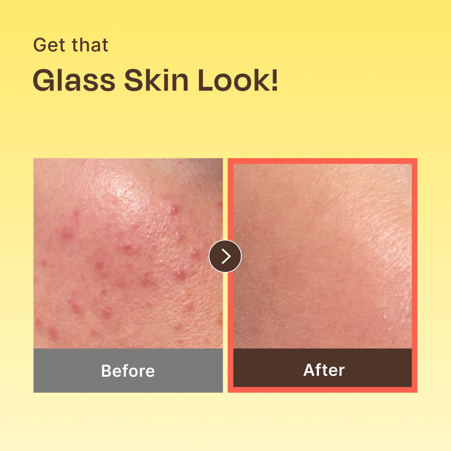 Banana PDRN 2x Serum